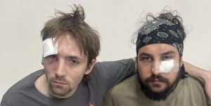 „Nejkrvavější volby.“ Novináři v Srbsku byli brutálně napadeni při své práci